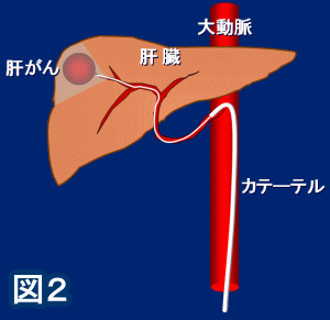 図2
